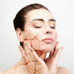 Penyebab Kulit Kering Saat Puasa Dan Cara Mengatasinya